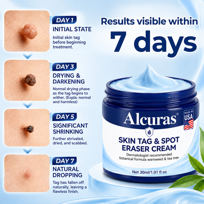Alcuras® 7-Day Skin Tag & Spot Eraser Cream