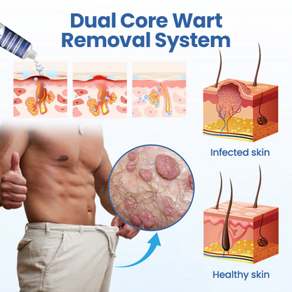 Alcuras® GentX WartRelief Cream
