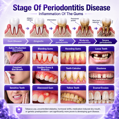 Alcuras® Gingivitis Periodontal Treatment Toothpaste
