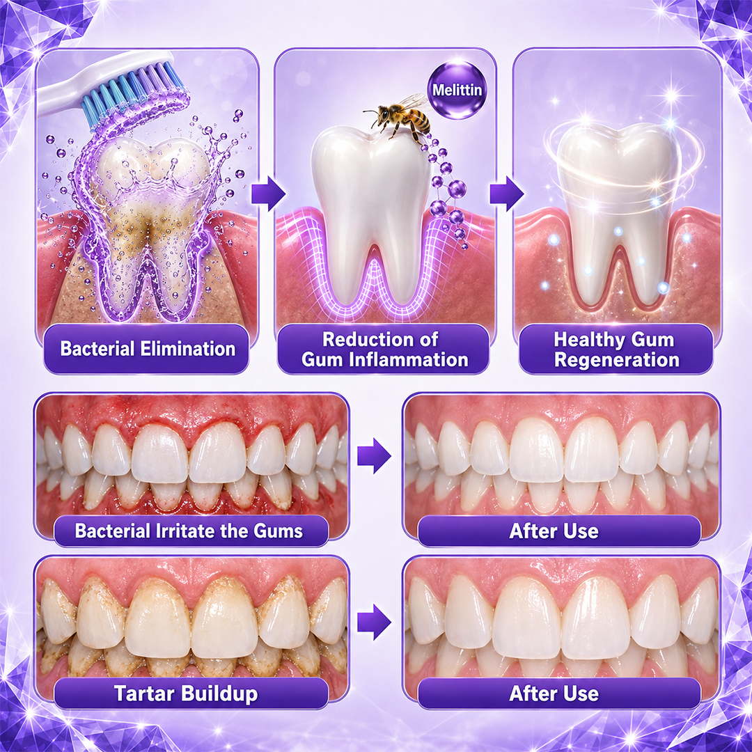 Alcuras® Gingivitis Periodontal Treatment Toothpaste