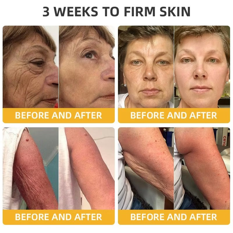 Alcuras® BeeLift Anti-Aging Firming Cream,Address Crepe & Sagging(🔥49% Off for a Limited Time!)