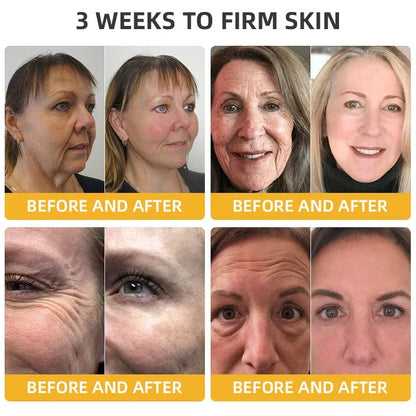 Alcuras® BeeLift Anti-Aging Firming Cream,Address Crepe & Sagging(🔥49% Off for a Limited Time!)