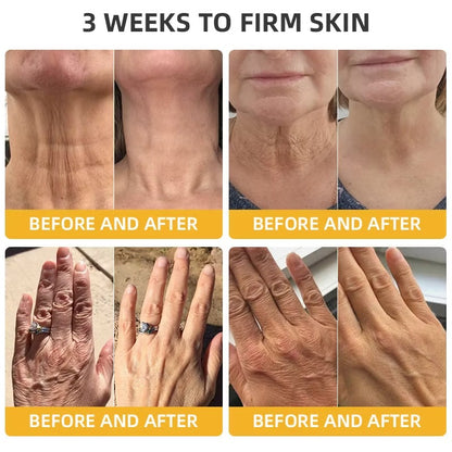 Alcuras® BeeLift Anti-Aging Firming Cream,Address Crepe & Sagging(🔥49% Off for a Limited Time!)
