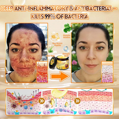 Alcuras Bee Venom Cream – Fast Skin Repair | Made in USA | 80% OFF!